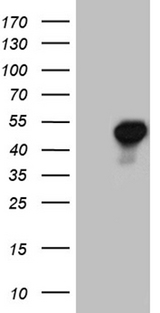 AZIN1 Antibody - HEK293T cells were transfected with the pCMV6-ENTRY control. (Left lane) or pCMV6-ENTRY AZIN1. (Right lane) cDNA for 48 hrs and lysed. Equivalent amounts of cell lysates. (5 ug per lane) were separated by SDS-PAGE and immunoblotted with anti-AZIN1.