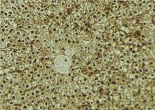 AZIN1 Antibody - 1:100 staining mouse liver tissue by IHC-P. The sample was formaldehyde fixed and a heat mediated antigen retrieval step in citrate buffer was performed. The sample was then blocked and incubated with the antibody for 1.5 hours at 22°C. An HRP conjugated goat anti-rabbit antibody was used as the secondary.