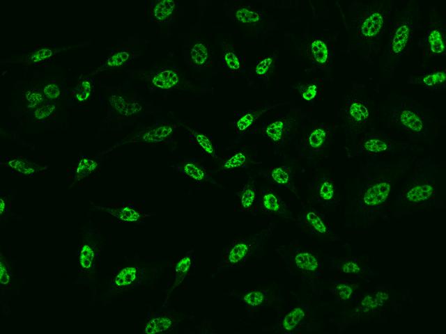 AZIN1 Antibody - Immunofluorescence staining of AZIN1 in Hela cells. Cells were fixed with 4% PFA, permeabilzed with 0.1% Triton X-100 in PBS, blocked with 10% serum, and incubated with rabbit anti-Human AZIN1 polyclonal antibody (dilution ratio 1:200) at 4°C overnight. Then cells were stained with the Alexa Fluor 488-conjugated Goat Anti-rabbit IgG secondary antibody (green). Positive staining was localized to Nucleus.