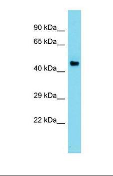 AZIN2 / Antizyme Inhibitor 2 Antibody - Western blot of Human Liver Tumor. ADC antibody dilution 1.0 ug/ml.  This image was taken for the unconjugated form of this product. Other forms have not been tested.