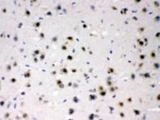 AZIN2 / Antizyme Inhibitor 2 Antibody - IHC testing of FFPE mouse brain with AZIN2 antibody at 1ug/ml. HIER: steam sections in pH6 citrate buffer.