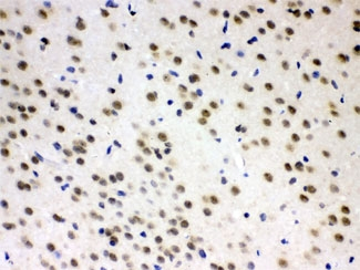 AZIN2 / Antizyme Inhibitor 2 Antibody - IHC testing of FFPE rat brain with AZIN2 antibody at 1ug/ml. HIER: steam sections in pH6 citrate buffer.