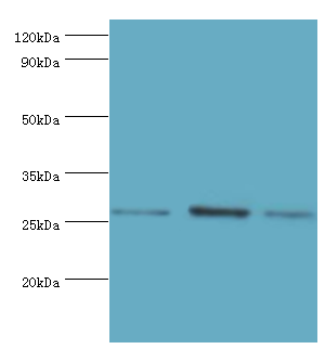 AZU1 / Azurocidin Antibody - Western blot. All lanes: Azurocidin antibody at 1 ug/ml. Lane 1: 293T whole cell lysate. Lane 2: mouse spleen tissue. Lane 3: mouse thymus tissue. Secondary antibody: Goat polyclonal to rabbit at 1:10000 dilution. Predicted band size: 27 kDa. Observed band size: 27 kDa.