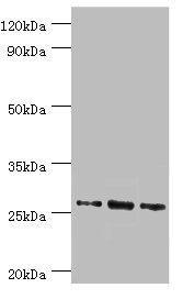 AZU1 / Azurocidin Antibody - Western blot All lanes: Azurocidin antibody at 1µg/ml Lane 1: 293T whole cell lysate Lane 2: Mouse spleen tissue Lane 3: Mouse thymus tissue Secondary Goat polyclonal to rabbit IgG at 1/10000 dilution Predicted band size: 27 kDa Observed band size: 27 kDa