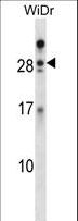 AZU1 / Azurocidin Antibody - AZU1 Antibody western blot of WiDr cell line lysates (35 ug/lane). The AZU1 antibody detected the AZU1 protein (arrow).
