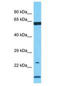 AZU1 / Azurocidin Antibody - AZU1 / Azurocidin antibody Western Blot of HT1080. Antibody dilution: 1 ug/ml.  This image was taken for the unconjugated form of this product. Other forms have not been tested.