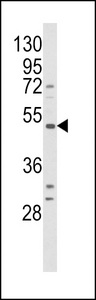 B1R / BDKRB1 Antibody - Western blot of BDKRB1 Antibody in HepG2 cell line lysates (35 ug/lane). BDKRB1 (arrow) was detected using the purified antibody.