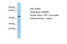 B1R / BDKRB1 Antibody -  This image was taken for the unconjugated form of this product. Other forms have not been tested.