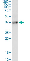 B1R / BDKRB1 Antibody - BDKRB1 monoclonal antibody (M04), clone 3A2. Western Blot analysis of BDKRB1 expression in human liver.