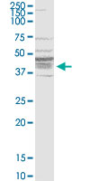 B1R / BDKRB1 Antibody - BDKRB1 monoclonal antibody (M04), clone 3A2. Western Blot analysis of BDKRB1 expression in MCF-7.