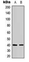 B1R / BDKRB1 Antibody - Western blot analysis of BDKRB1 expression in Saos2 (A); SW837 (B) whole cell lysates.