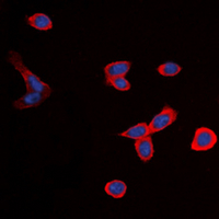 B1R / BDKRB1 Antibody - Immunofluorescent analysis of BDKRB1 staining in Saos2 cells. Formalin-fixed cells were permeabilized with 0.1% Triton X-100 in TBS for 5-10 minutes and blocked with 3% BSA-PBS for 30 minutes at room temperature. Cells were probed with the primary antibody in 3% BSA-PBS and incubated overnight at 4 ??C in a humidified chamber. Cells were washed with PBST and incubated with a DyLight 594-conjugated secondary antibody (red) in PBS at room temperature in the dark. DAPI was used to stain the cell nuclei (blue).