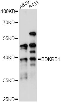 B1R / BDKRB1 Antibody - Western blot analysis of extracts of various cell lines, using BDKRB1 antibody at 1:1000 dilution. The secondary antibody used was an HRP Goat Anti-Rabbit IgG (H+L) at 1:10000 dilution. Lysates were loaded 25ug per lane and 3% nonfat dry milk in TBST was used for blocking. An ECL Kit was used for detection and the exposure time was 5s.