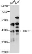 B1R / BDKRB1 Antibody - Western blot analysis of extracts of various cell lines, using BDKRB1 antibody at 1:1000 dilution. The secondary antibody used was an HRP Goat Anti-Rabbit IgG (H+L) at 1:10000 dilution. Lysates were loaded 25ug per lane and 3% nonfat dry milk in TBST was used for blocking. An ECL Kit was used for detection and the exposure time was 5s.