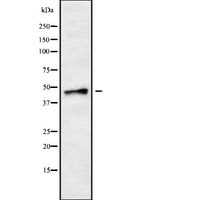 B1R / BDKRB1 Antibody - Western blot analysis of BDKRB1 using HeLa whole cells lysates