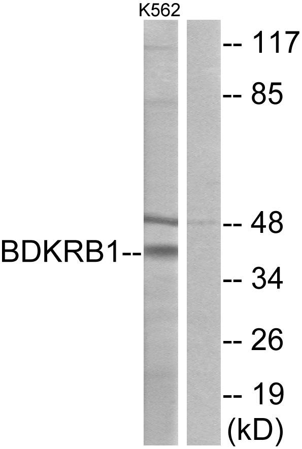 B1R / BDKRB1 Antibody - Western blot analysis of extracts from K562 cells, using BDKRB1antibody.