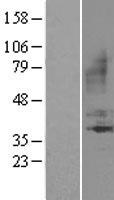 B1R / BDKRB1 Protein - Western validation with an anti-DDK antibody * L: Control HEK293 lysate R: Over-expression lysate