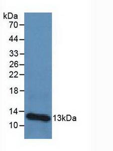 B2M / Beta 2 Microglobulin Antibody - Western Blot; Sample: Human Urine Tissue.