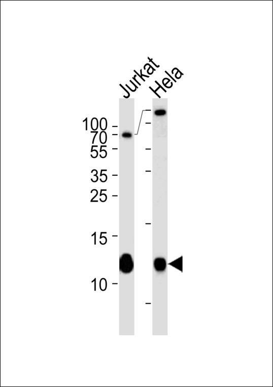 B2M / Beta 2 Microglobulin Antibody - B2M Antibody western blot of Jurkat,HeLa cell line lysates (35 ug/lane). The B2M antibody detected the B2M protein (arrow).