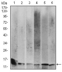 B2M / Beta 2 Microglobulin Antibody - Western blot using B2M mouse monoclonal antibody against HeLa (1), HEK293 (2), HepG2 (3),RAJI (4), A431 (5) and Jurkat (6) cell lysate.