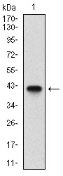 B2M / Beta 2 Microglobulin Antibody - Western blot using B2M monoclonal antibody against human B2M (AA: 21-100) recombinant protein. (Expected MW is 35.4 kDa)