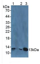 B2M / Beta 2 Microglobulin Antibody - Western Blot; Sample: Lane1: Human Leukocytes Cells; Lane2: Human Liver Tissue; Lane3: Human Urine.