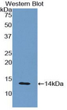 B2M / Beta 2 Microglobulin Antibody - Western blot of recombinant B2M / Beta 2 Microglobulin.  This image was taken for the unconjugated form of this product. Other forms have not been tested.