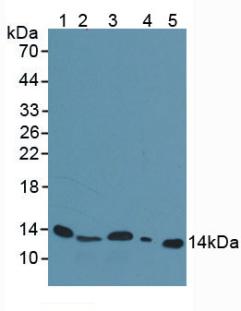 B2M / Beta 2 Microglobulin Antibody - Western Blot; Sample: Lane1: Mouse Serum; Lane2: Mouse Spleen Tissue; Lane3: Mouse Liver Tissue; Lane4: Rat Liver Tissue; Lane5: Human Urine.