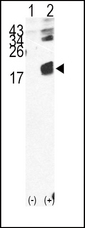 B2M / Beta 2 Microglobulin Antibody - Western blot of B2M (arrow) using rabbit polyclonal B2M Antibody (RB14679). 293 cell lysates (2 ug/lane) either nontransfected (Lane 1) or transiently transfected with the B2M gene (Lane 2) (Origene Technologies).