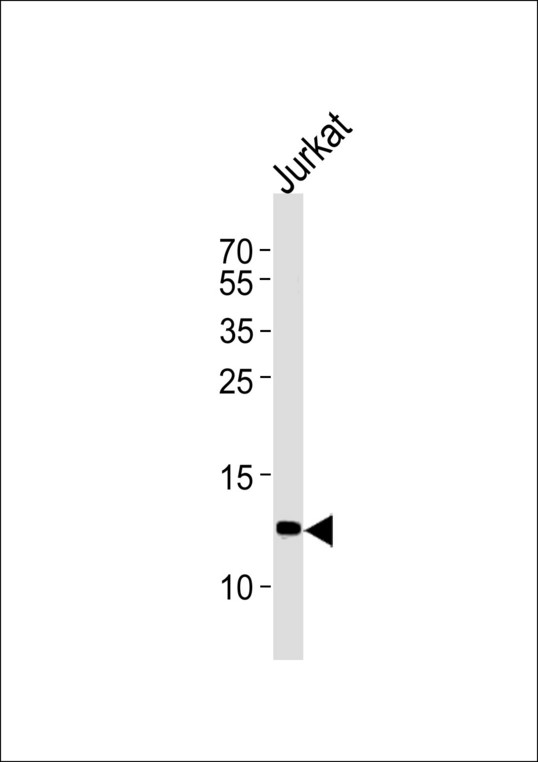 B2M / Beta 2 Microglobulin Antibody - B2M Antibody western blot of Jurkat cell line lysates (35 ug/lane). The B2M antibody detected the B2M protein (arrow).