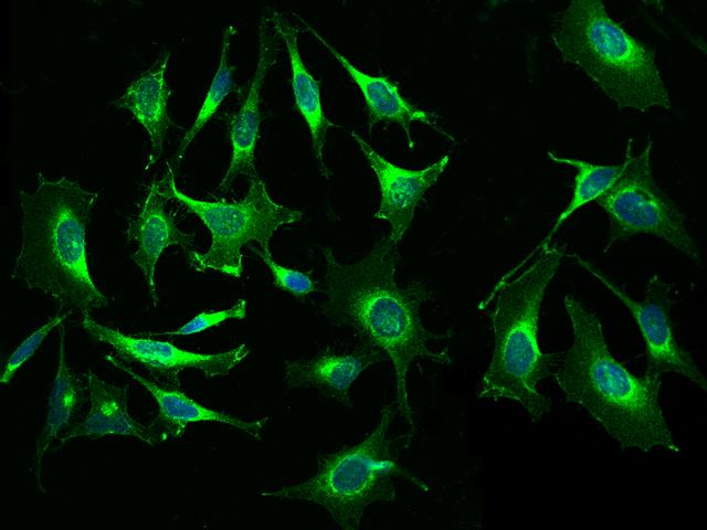 B2M / Beta 2 Microglobulin Antibody - Immunofluorescence staining of B2M in Hela cells. Cells were fixed with 4% PFA, permeabilzed with 0.1% Triton X-100 in PBS, blocked with 10% serum, and incubated with mouse anti-human B2M monoclonal antibody (dilution ratio 1:60) at 4°C overnight. Then cells were stained with the Alexa Fluor 488-conjugated Goat Anti-mouse IgG secondary antibody (green) and counterstained with DAPI (blue). Positive staining was localized to Cytoplasm and cell membrane.