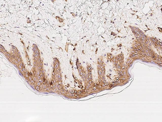 B2M / Beta 2 Microglobulin Antibody - Immunochemical staining of human B2M in human skin with mouse monoclonal antibody at 1:60 dilution, formalin-fixed paraffin embedded sections.