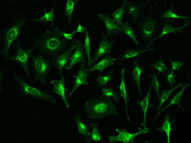 B2M / Beta 2 Microglobulin Antibody - Immunofluorescence staining of B2M in Hela cells. Cells were fixed with 4% PFA, permeabilzed with 0.1% Triton X-100 in PBS, blocked with 10% serum, and incubated with mouse anti-human B2M monoclonal antibody (dilution ratio 1:60) at 4°C overnight. Then cells were stained with the Alexa Fluor488-conjugated Goat Anti-mouse IgG secondary antibody (green). Positive staining was localized to Cytoplasm.