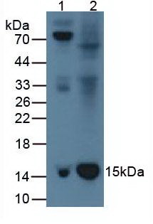 B2M / Beta 2 Microglobulin Antibody