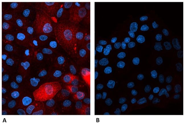 B2M / Beta 2 Microglobulin Antibody - beta-2 Microglobulin Antibody in Immunofluorescence (IF)