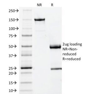 B2M / Beta 2 Microglobulin Antibody - SDS-PAGE Analysis of Purified, BSA-Free Beta-2 Microglobulin Antibody (clone BBM.1). Confirmation of Integrity and Purity of the Antibody.