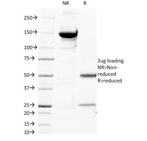 B2M / Beta 2 Microglobulin Antibody - SDS-PAGE Analysis of Purified, BSA-Free Beta-2 Microglobulin Antibody (clone C21.48A1). Confirmation of Integrity and Purity of the Antibody.