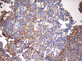B2M / Beta 2 Microglobulin Antibody - IHC of paraffin-embedded Human tonsil using anti-B2M mouse monoclonal antibody. (Heat-induced epitope retrieval by 10mM citric buffer, pH6.0, 120°C for 3min).