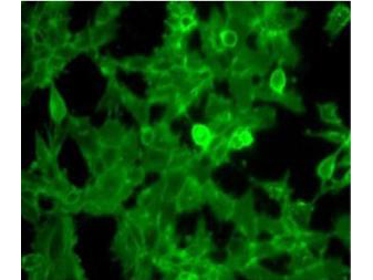 B2M / Beta 2 Microglobulin Antibody - Immunofluorescence Microscopy of Rabbit Anti-Beta-2-microglobulin antibody. Tissue: Human Embryonic Kidney cells (HEK 293 cells). Fixation: 2% paraformaldehyde for 15 minutes. Antigen retrieval: not required. Primary antibody: ß-2 microglobulin antibody at 1:200 for overnight at 4°C. Secondary antibody: donkey anti-rabbit secondary antibody conjugated with Alexa Fluor 488 fluorochrome at 1:1,000 for 45 min at RT. Localization: ß2-microglobulin is mainly on the cell surface and occasionally cytoplasmic. Staining: Beta-2-microglobulin as green fluorescent signal.