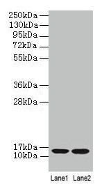 B2M / Beta 2 Microglobulin Antibody - Western blot All lanes: Beta-2-microglobulin antibody at 2µg/ml Lane 1: A431 whole cell lysate Lane 2: Mouse lungs tissue Secondary Goat polyclonal to rabbit IgG at 1/10000 dilution Predicted band size: 12 kDa Observed band size: 12 kDa