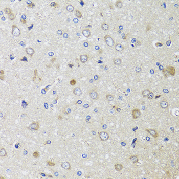 B2M / Beta 2 Microglobulin Antibody - Immunohistochemistry of paraffin-embedded rat brain using B2M antibody at dilution of 1:100 (40x lens).