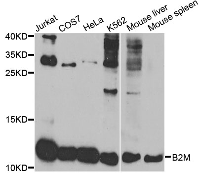 B2M / Beta 2 Microglobulin Antibody - Western blot analysis of extracts of various cell lines, using B2M antibody at 1:1000 dilution. The secondary antibody used was an HRP Goat Anti-Rabbit IgG (H+L) at 1:10000 dilution. Lysates were loaded 25ug per lane and 3% nonfat dry milk in TBST was used for blocking. An ECL Kit was used for detection.