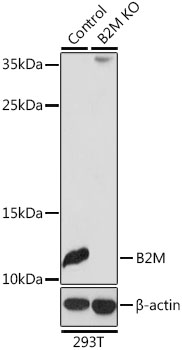 B2M / Beta 2 Microglobulin Antibody - Western blot analysis of extracts from normal (control) and B2M knockout (KO) 293T cells, using B2M antibody at 1:3000 dilution. The secondary antibody used was an HRP Goat Anti-Rabbit IgG (H+L) at 1:10000 dilution. Lysates were loaded 25ug per lane and 3% nonfat dry milk in TBST was used for blocking. An ECL Kit was used for detection and the exposure time was 90s.