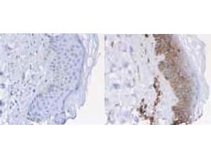 B2M / Beta 2 Microglobulin Antibody - Immunohistochemistry of Rabbit anti-Beta-2-Microglobulin Antibody. Tissue: normal human skin. Fixation: formalin fixed paraffin embedded. Antigen retrieval: not required. Primary antibody: Left panel: isotype control, Right panel: ß2 microglobulin antibody at 1 ug/ml for 20 min at RT. Secondary antibody: Peroxidase rabbit secondary antibody at 1:10,000 for 45 min at RT. Localization: ß2 microglobulin is cell membrane (and to lesser amount cytoplasmatic compartment). Staining: Beta-2-Microglobulin as brown with diaminobenzidine and with a hematoxylin purple counterstain.