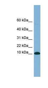 B2M / Beta 2 Microglobulin Antibody - B2M / Beta-2-Microglobulin antibody Western blot of Fetal Thymus lysate. This image was taken for the unconjugated form of this product. Other forms have not been tested.