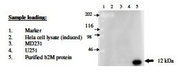 B2M / Beta 2 Microglobulin Antibody - Immunodetection Analysis: The membrane blot was probed with anti- beta2 M primary antibody(1µg/ml). Proteins were visualized using a goat anti-mouse secondary antibody conjugated to HRP and chemiluminescence detection system. Arrows indicate cellular recombinant beta2 M (12 kDa).