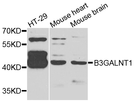 B3GALNT1 Antibody - Western blot analysis of extracts of various cells.