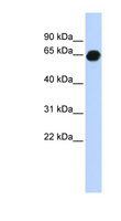 B3GALNT2 Antibody - B3GALNT2 antibody Western blot of Fetal Brain lysate. This image was taken for the unconjugated form of this product. Other forms have not been tested.