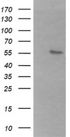 B3GALNT2 Antibody - HEK293T cells were transfected with the pCMV6-ENTRY control (Left lane) or pCMV6-ENTRY B3GALNT2 (Right lane) cDNA for 48 hrs and lysed. Equivalent amounts of cell lysates (5 ug per lane) were separated by SDS-PAGE and immunoblotted with anti-B3GALNT2.