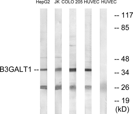 B3GALT1 Antibody - Western blot analysis of lysates from HUVEC, COLO, Jurkat, and HepG2 cells, using B3GALT1 Antibody. The lane on the right is blocked with the synthesized peptide.